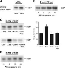 Presentations using powerpoint can include images, text, audio, video, charts, graphs, hyperlinks, and animation to. Aldosterone Inhibits Apical Nhe3 And Hco3 Absorption Via A Nongenomic Erk Dependent Pathway In Medullary Thick Ascending Limb American Journal Of Physiology Renal Physiology
