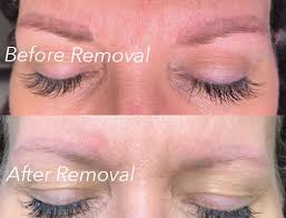 Brittany always tries her best not to put a client in this situation. Permanent Makeup Removal Color Correction Orange County Ca