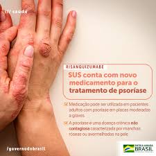 Tenho evitado de o fazer, principalmente porque a discriminação existe. Centro De Referencia Apoio E Tratamento Aos Portadores Da Psoriase Da Pb Home Facebook