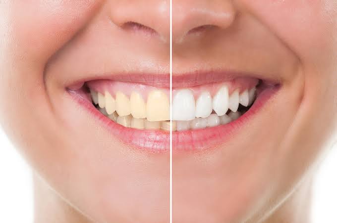 COSMETIC DENTISTRY