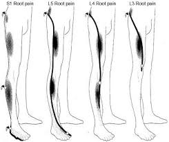 Pin On L5 S1 And The Body