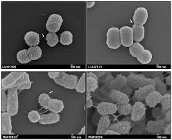 Image result for Striga baumannii