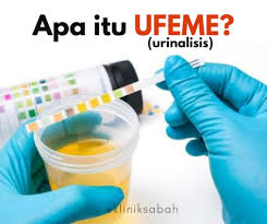 Air kecil, air seni) adalah bahan kumbahan cecair yang disingkirkan dari badan buah pinggang melalui proses penapisan darah yang dikenali sebagai kencing dan dikeluarkan melalui saluran khusus. Apa Itu Urinalisis Ufeme Klinik Sabah