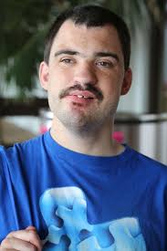 Dup15q Alliance provides family support and promotes awareness, research  and targeted treatments for dup15q syndrome.