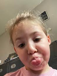 Good morning friends! Updates for Berkley will probably look similar for a  while but she is okay. The doctors are just letting her grow. She is  getting feeds and will hopefully get