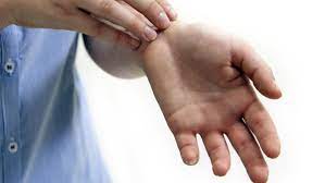 Gatal pada telapak tangan bisa disebabkan oleh berbagai faktor atau kondisi penyakit. Jika Telapak Kiri Pertanda Tergores Mengapa Telapak Tangan Kanan Atau Kiri Gatal Interpretasi Tanda