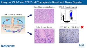 Check spelling or type a new query. Cell Therapy In Situ Hybridization Rna Ish Acdbio