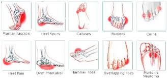 Do You Suffer From Pain In Your Foot Arch Put Your Feet In