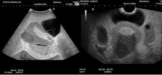Maybe you would like to learn more about one of these? Female Pelvic Ultrasound Phantom Kyoto Kagaku