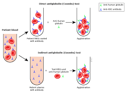 Image result for Direct Coombs