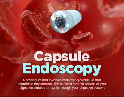 Image result for Wireless Capsule Endoscopy