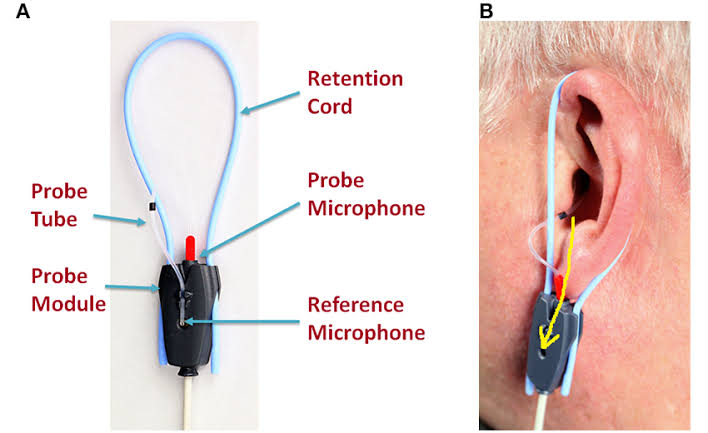 Considerations in Real-Ear Measurement: Points to Ponder | Canadian  Audiologist