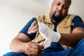 Image result for Hand Injury