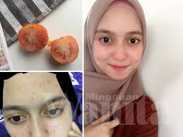 Terimakasih sudah mengunjungi situs kami. 8 Bulan Wanita Ini Cuci Muka Guna Tomato Beku Kesannya Hilang Habis Jerawat Degil Kulit Pinkish Berseri Mingguan Wanita