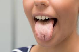 Punca utama mulut berbau adalah dari bakteria yang membiak di dalam mulut. Halitosis Penyebab Cara Mengatasi Mulut Berbau Ketika Hamil Mama S Choice Malaysia