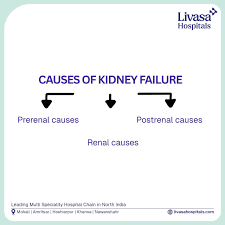 Image result for Postrenal Failure