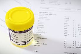 9 Weird Ways You Can Test Positive For Drugs Live Science