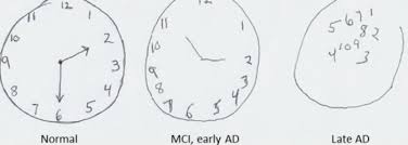 The clock drawing test (cdt) is frequently used to detect changes in cognition. Donald Trump Scored Top Marks In A Cognitive Test Here S What He Was Tested On Abc News