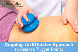 cupping an effective approach to release trigger points