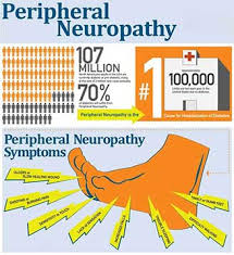 Image result for Peripheral Neuropathy