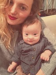 Public Buzz : Photos : Micah, 11 mois, trisomique et déjà mannequin !