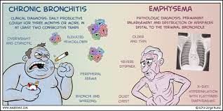 Since chronic bronchitis and emphysema affect your lungs, they can exhibit similar symptoms. Chronic Bronchitis Vs Emphysema Copd Nursing Nursing Care Nursing School Survival