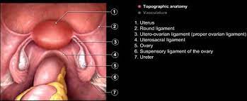 • laparoscopic pelvic reconstruction (lpr) with vaginal hysterectomy useful when vaginal hysterectomy alone cannot accomplish appropriate repair for vaginal prolapse. Laparoscopic Management Of Ovarian Disease
