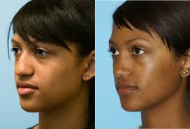 Balikian Facial Plastic Surgery