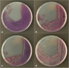 Designation of salmonella enterica (ex kauffmann and edwards 1952) le minor and popoff 1987 sp. Chromogenic Media For The Detection Of Salmonella Enterica Serovar Paratyphi A In Human Stool Samples Evaluation In A Reference Setting Springerlink
