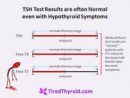 Tsh Test Results Are Often Normal Even With Hypothyroid