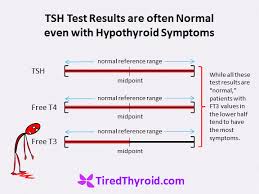 tsh test results are often normal even with hypothyroid