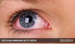 goz kanlanmasina ne iyi gelir spor ve beslenme