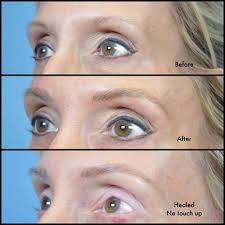 Heidi Carney On Instagram This Lady Atlanta Browdiaries Browlife Browtattoo Hairstrokes M Permanent Makeup Eyebrows Microblading Microblading Eyebrows