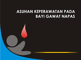 2.2.1 sianosis sentral pada sianosis sentral, terdapat penurunan jumlah saturasi oksigen atau derivat hemoglobin yang abnormal. Skor Frekuensi Napas Sianosis Udara Masuk Merintih Retraksi