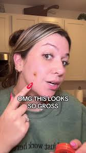 Prid Drawing Salve Removes 20-Year-Old Splinter