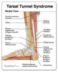 Pin On Foot Pain