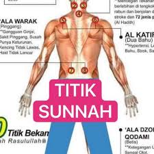 Dr wada membahagikan titik bekam kepada tiga iaitu titik umum, titik organ, titik setempat. Titik Bekam Asam Lambung