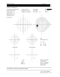 Visual Field Testing