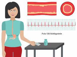 Blutdruck Und Puls Infothek Blutdruckdaten