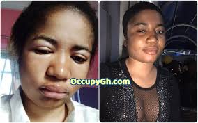 Please let's pray for her ada nothing will happen to you in jesus name amen. Oldow3dh0fpkhm