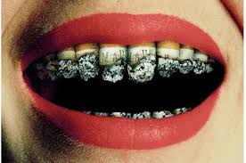 Floss in the shower, floss while you're watching tv, or heck, pick up some. Can I Vape After Getting Dental Implants Dental Implant Center