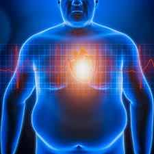 Image result for Obesity