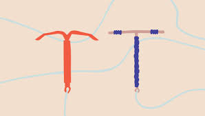 A device inside your uterus). What Is An Iud The Ins And Outs Of The Intrauterine Device