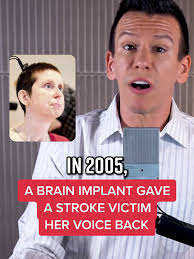 Stroke Victim Ai Video