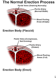 When ed becomes a routine and bothersome what is the surgery like? What Causes Erectile Dysfunction Impotence Treatment Symptoms
