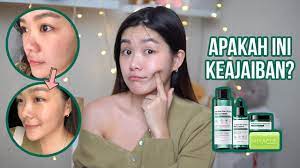 Gentle exfoliating cleansing bar some by mi 30 days miracle cleansing bar works as an exfoliator to leave skin cleaner and more radiant than before! Racunmomo Some By Mi Aha Bha Pha 30 Days Miracle Line Youtube