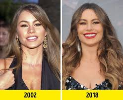From billionaire kylie jenner to the beautiful gigi hadid, a serena is the only player to win 23 grand slams (most by any tennis player: 17 Female Celebrities Who Make 40 Look Like 25