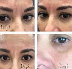 Light skin ladies 😅😅🙄😒