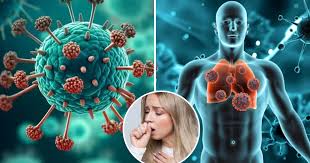 HMPV Virus Symptoms: जिसका डर था वही हुआ, भारत पहुंचा चीन का घातक HMPV वायरस,  कोरोना की तरह दिख रहे 7 लक्षण - after china first case of hmpv virus found  in