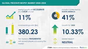 In fact, most people don't even know what it does. Prostate Biopsy Market Research 2020 2024 Growing Incidences Of Prostate Cancer To Influence Market Growth Technavio Business Wire